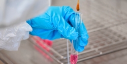 The owner of the company "Promomed" Petr Bely: how to put together a billion dollars for HIV and oncology